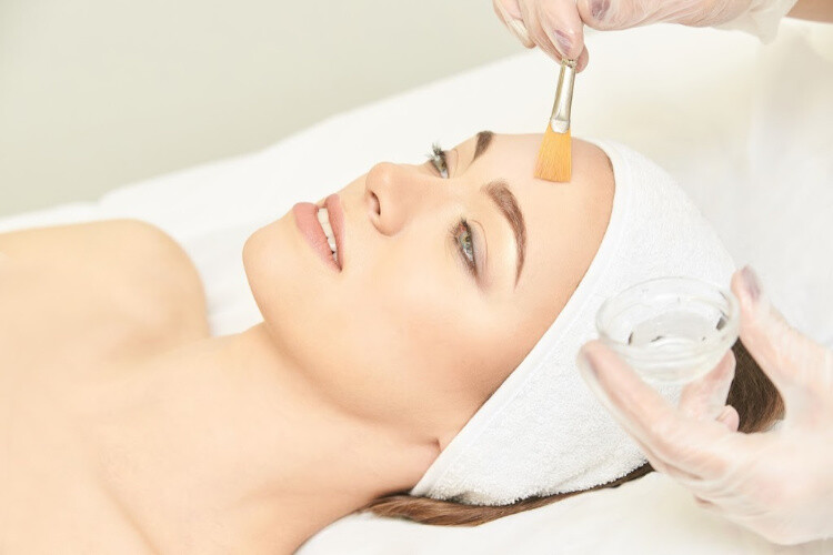 chemical peel fort myers